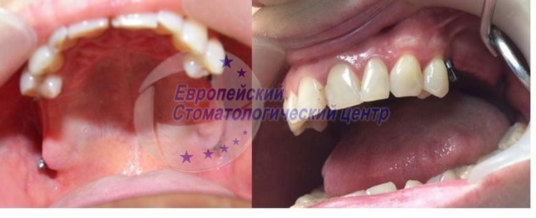 raboti14p2