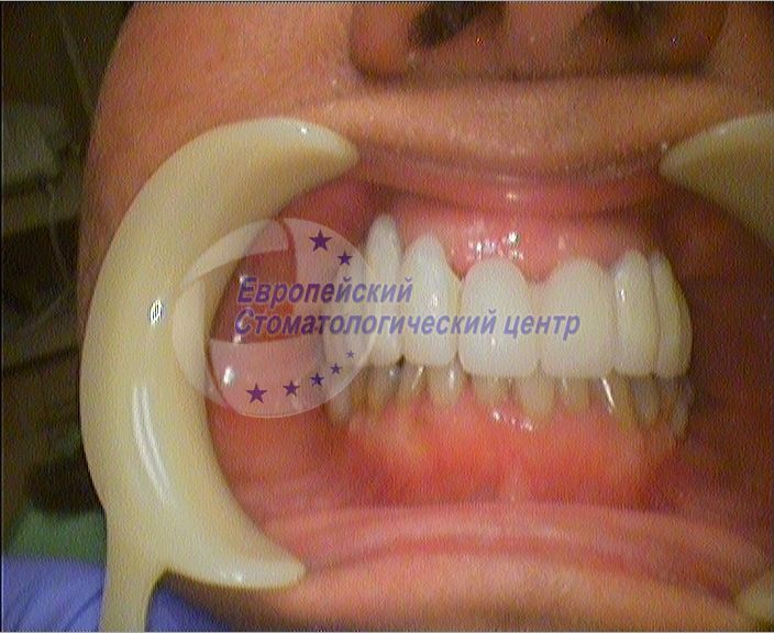 raboti6p3